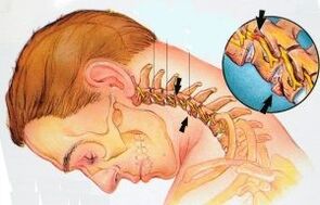 The cervix department