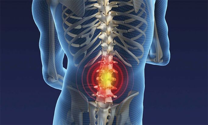 Pain in the lumbar region
