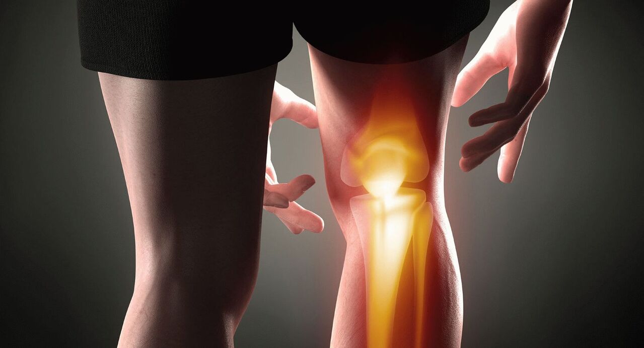 Symptoms of osteoarthritis