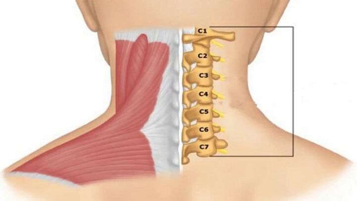 Radicular syndrome manifests itself depending on which vertebra is compressing the nerve endings